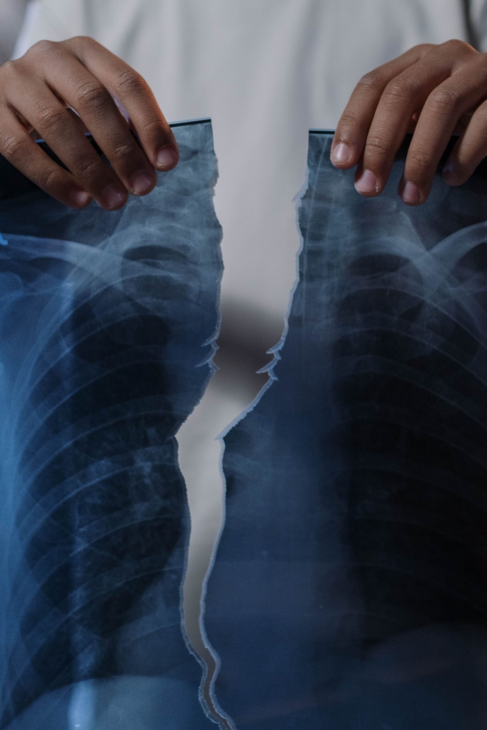 Medical Malpractice Case